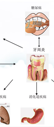 牙周病危害图解二:吸烟是导致牙周病发的一大害!